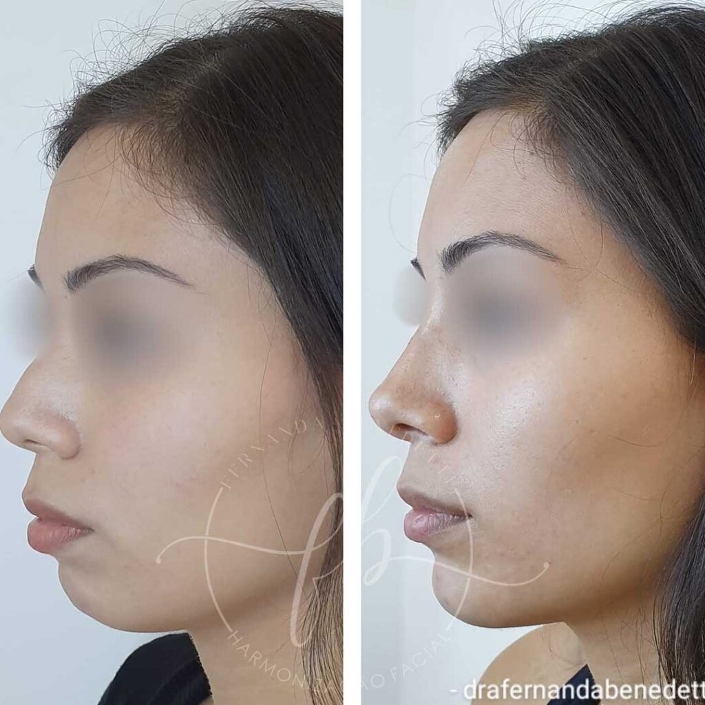 Full Face