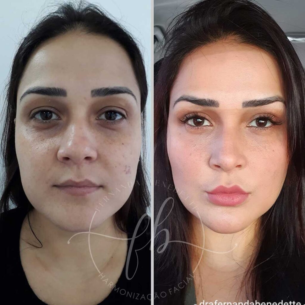 Full Face